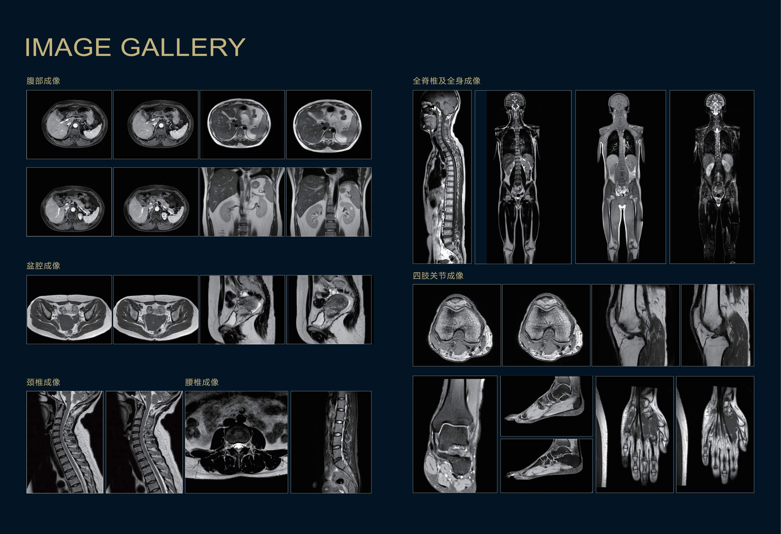 Apsaras飛天 1.5T 超導核磁共振系統